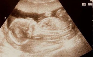 试管移植打赛增有四大好处，提高卵子质量只是一方面